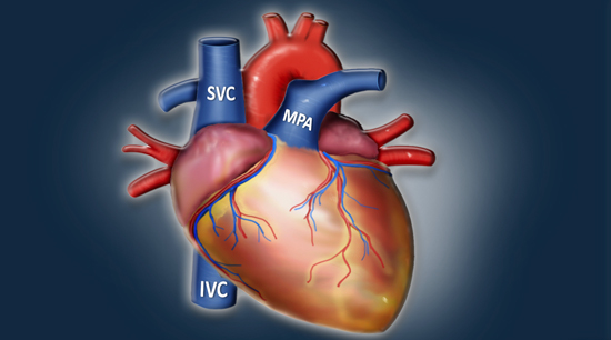 Cardiovascular Pearls on Chest CT...