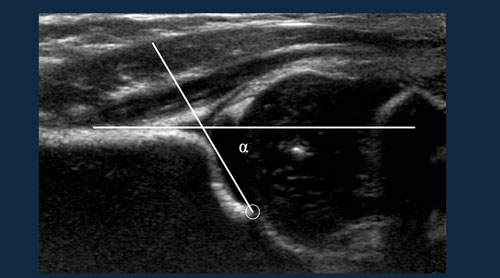 Normal Values in Pediatric Ultrasound