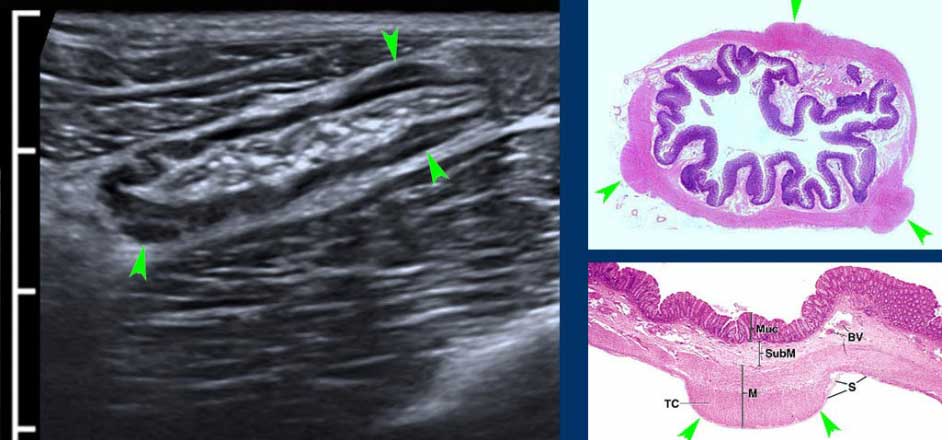 (M= muscularis, BV= Bloodvessels, S= serosa, TC= tenia coli)