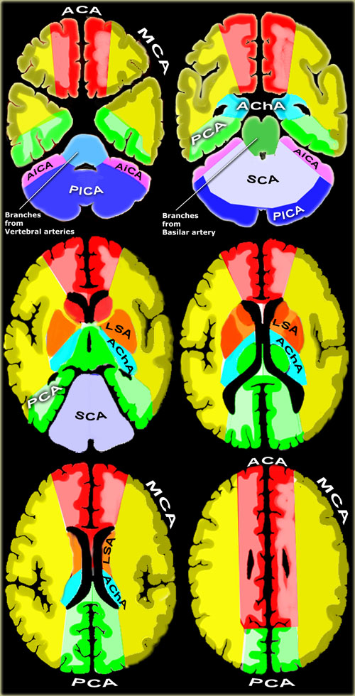 Vascular territories of the cerebral arteries (adapted and modified with permission from M. Savoiardo (1)