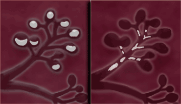 LEFT: Lobular calcifications: punctate, round or 'milk of calcium'  RIGHT: Intraductal calcifications: pleomorph and form casts in a linear or branching distribution.