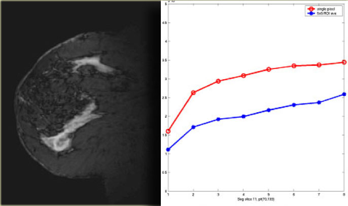 Type 1 curve with slow rise and a continued rise with tim