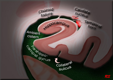 Coronal image of the hippocampus.