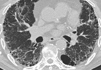 UIP: Typical case