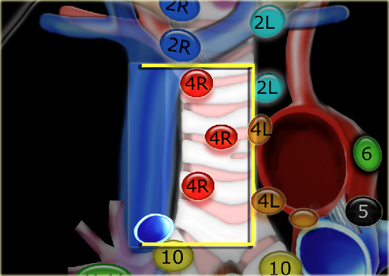 4R. Lower Paratracheal nodes