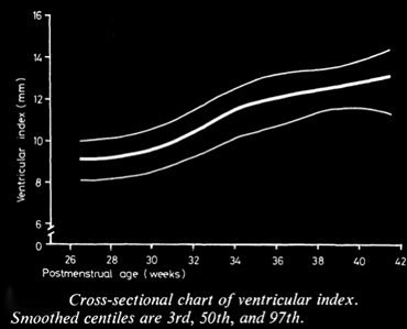 Measurement of the falx to the most lateral point of the lateral ventricle.