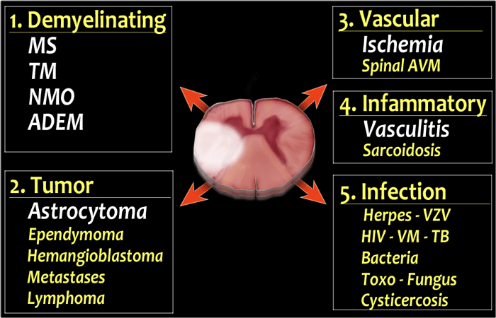 Spinal cord abnormalities. Common causes in white and uncommon causes in yellow.