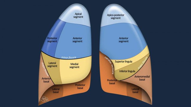 Lung Segments and Bronchi