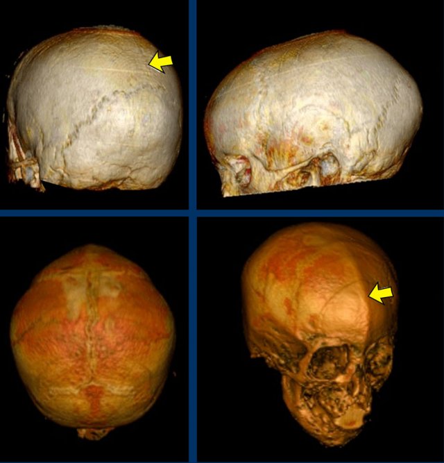 Images courtesy of Dr K.A. Eley and Dr C. Delso