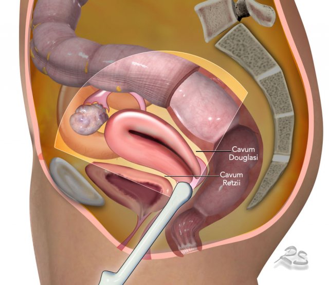 Pelvic anatomy