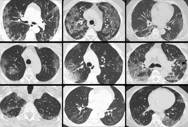 Proven COVID-19 cases. Click on image to enlarge.