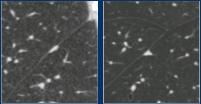 Typical PFNs. Images from Ref [Hoop].